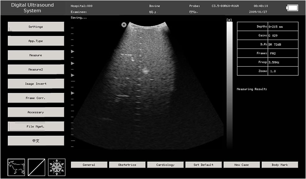 Portable Laptop B-Ultrasound Scanner Machine for Horse/Equine/Sheep Big Animal Use Q70659